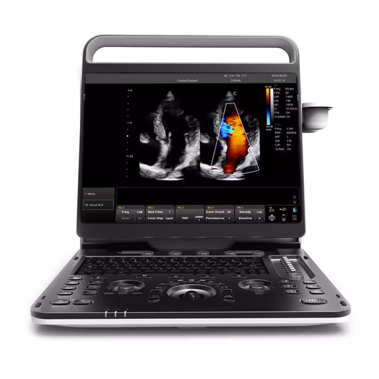 Chison Ebit30 4D 5D Tragbares Farbdoppler-Digitaldiagnostik-Bildgebungssystem Menschlicher Ultraschall Gynäkologie, kardiovaskuläres Echogerät